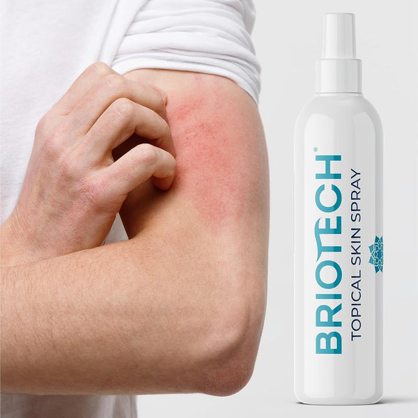Briotech Topical Skin Spray Hypochlorous Acid Spray 4oz/120ml