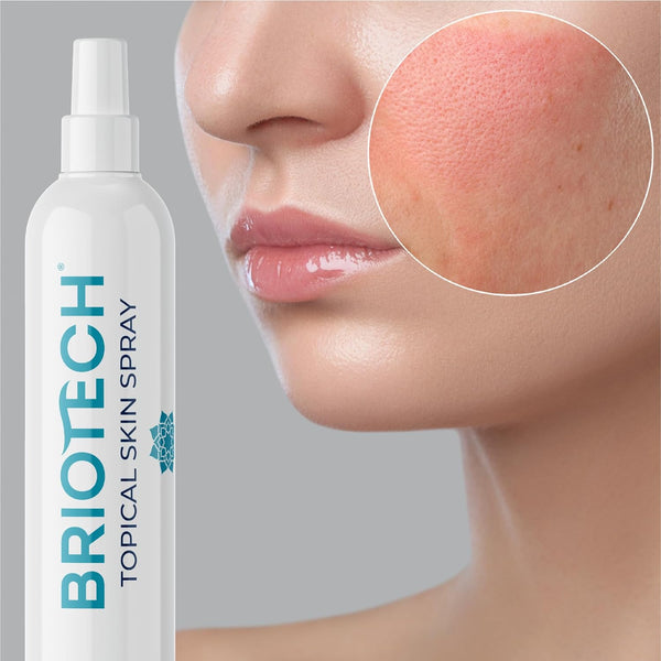 Briotech Topical Skin Spray Hypochlorous Acid Spray 4oz/120ml