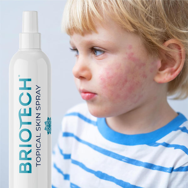 Briotech Topical Skin Spray Hypochlorous Acid Spray 4oz/120ml