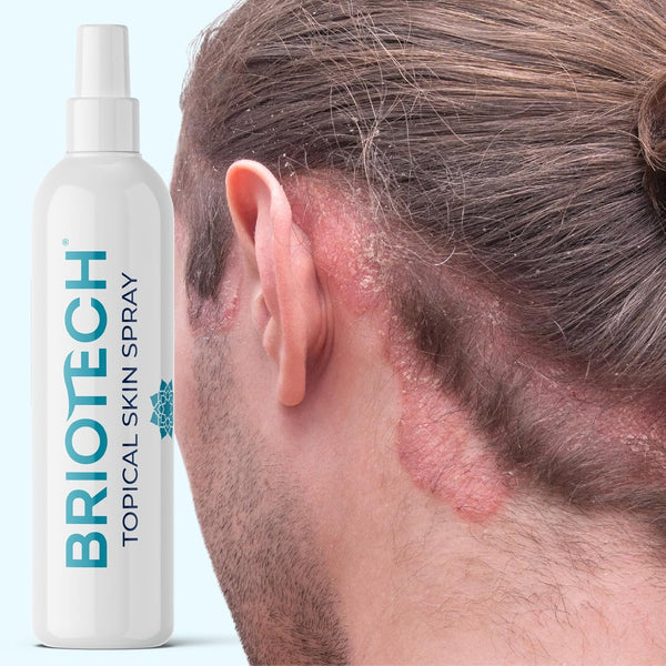 Briotech Topical Skin Spray Hypochlorous Acid Spray 4oz/120ml