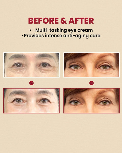 K-SECRET SEOUL 1988 Eye Cream 30ML : Retinal Liposome 4% + Fermented Bean 30ml