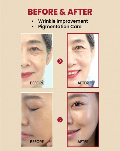 KSECRET - SEOUL 1988 Serum Retinal Liposome 2% + Black Ginseng 30ml BRISBANE
